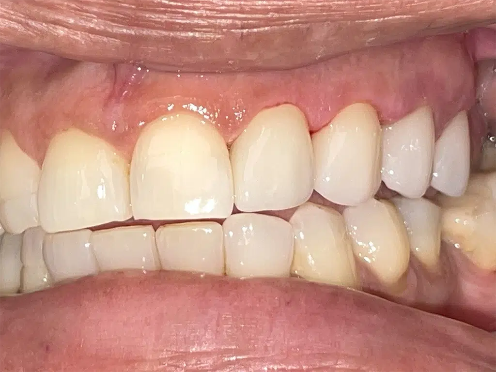 Dental Famidental of Burke