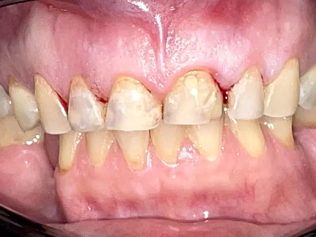 Dental Famidental of Burke