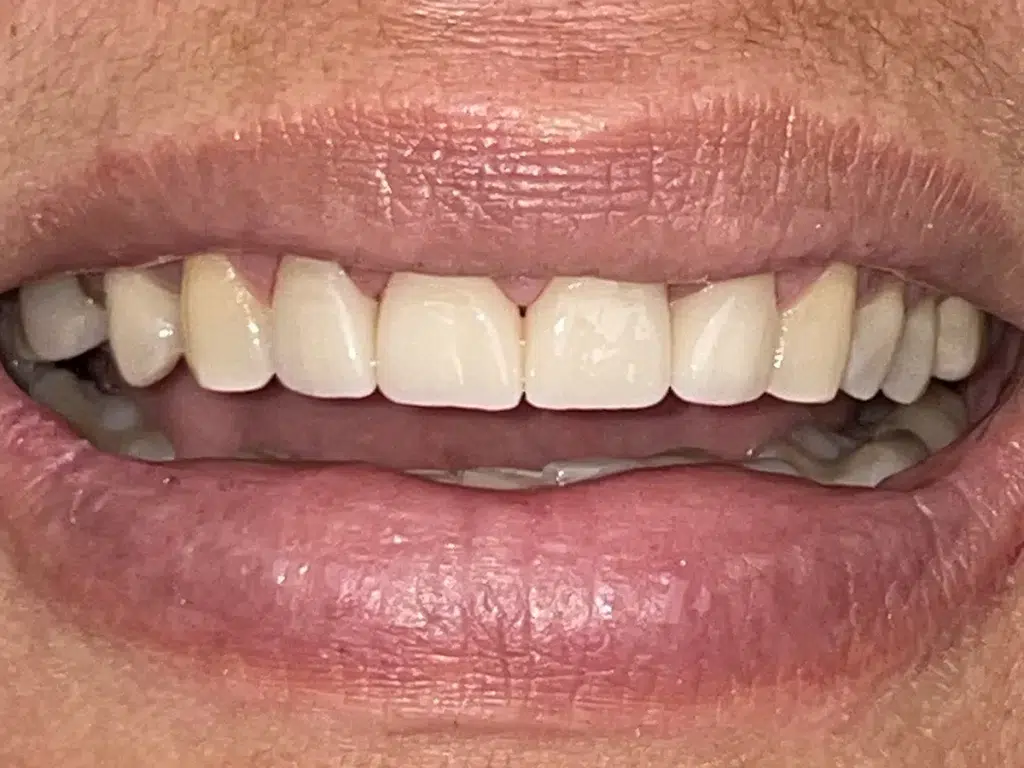 Dental Famidental of Burke