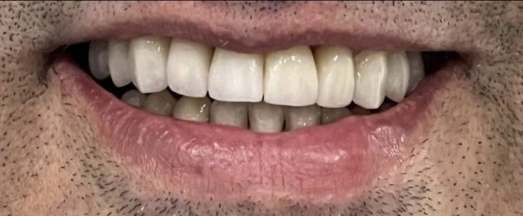 Dental Famidental of Burke